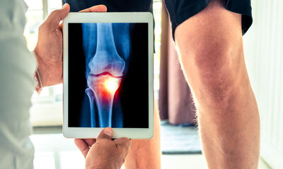 Douleurs articulaires Arthrose ou arthrite ? Douleurs articulaires Arthrose ou arthrite ?
