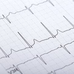 Électrocardiogramme Un examen indispensable pour le cœur Électrocardiogramme Un examen indispensable pour le cœur